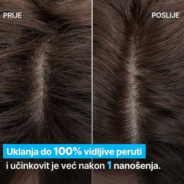 SLAJD-PRIJE-POSLE